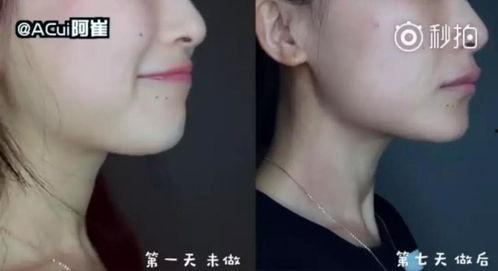 明星怎么去除双下巴,轻松告别双下巴，焕发青春光彩